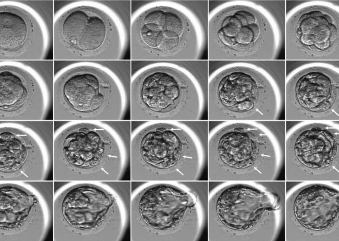 Embryo development review on different days in the laboratory.