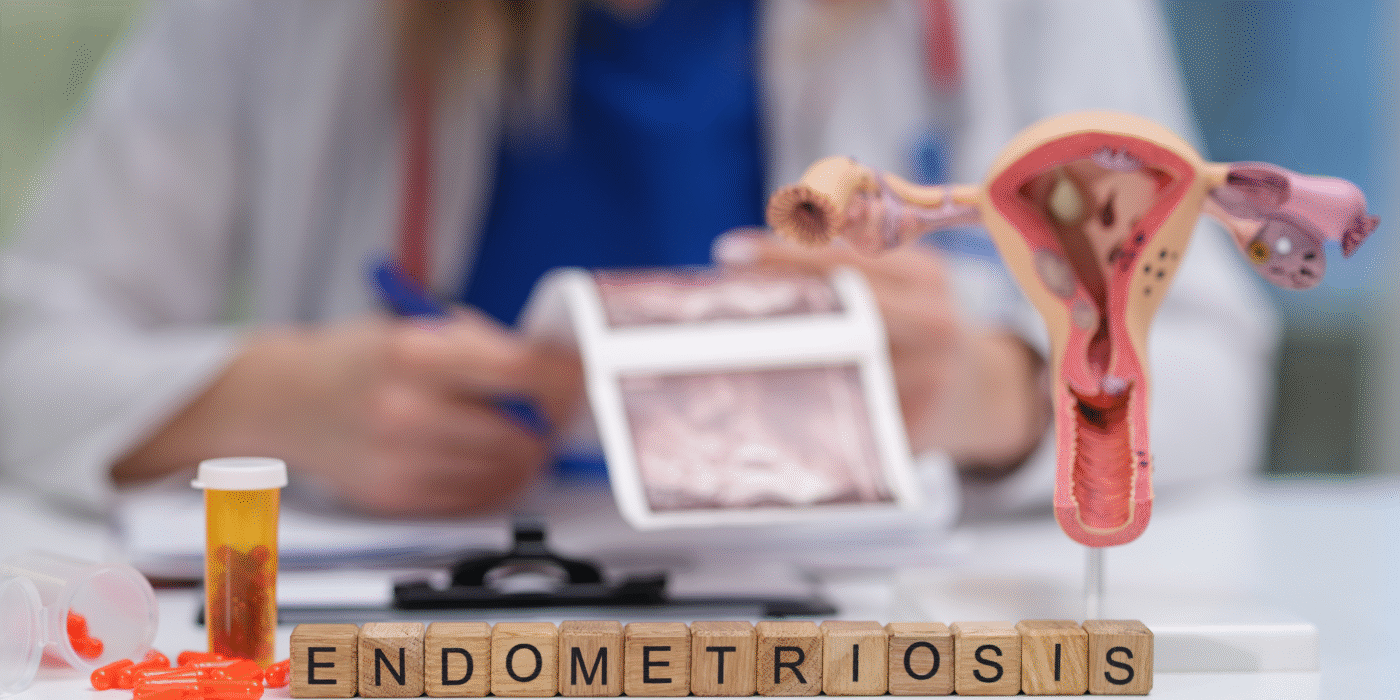 Illustration of endometriosis and adenomyosis highlighting hidden challenges in women’s health, fertility, and gynecological conditions