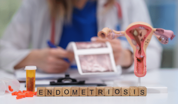 Illustration of endometriosis and adenomyosis highlighting hidden challenges in women’s health, fertility, and gynecological conditions